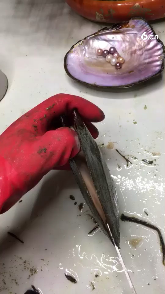 河蚌结石