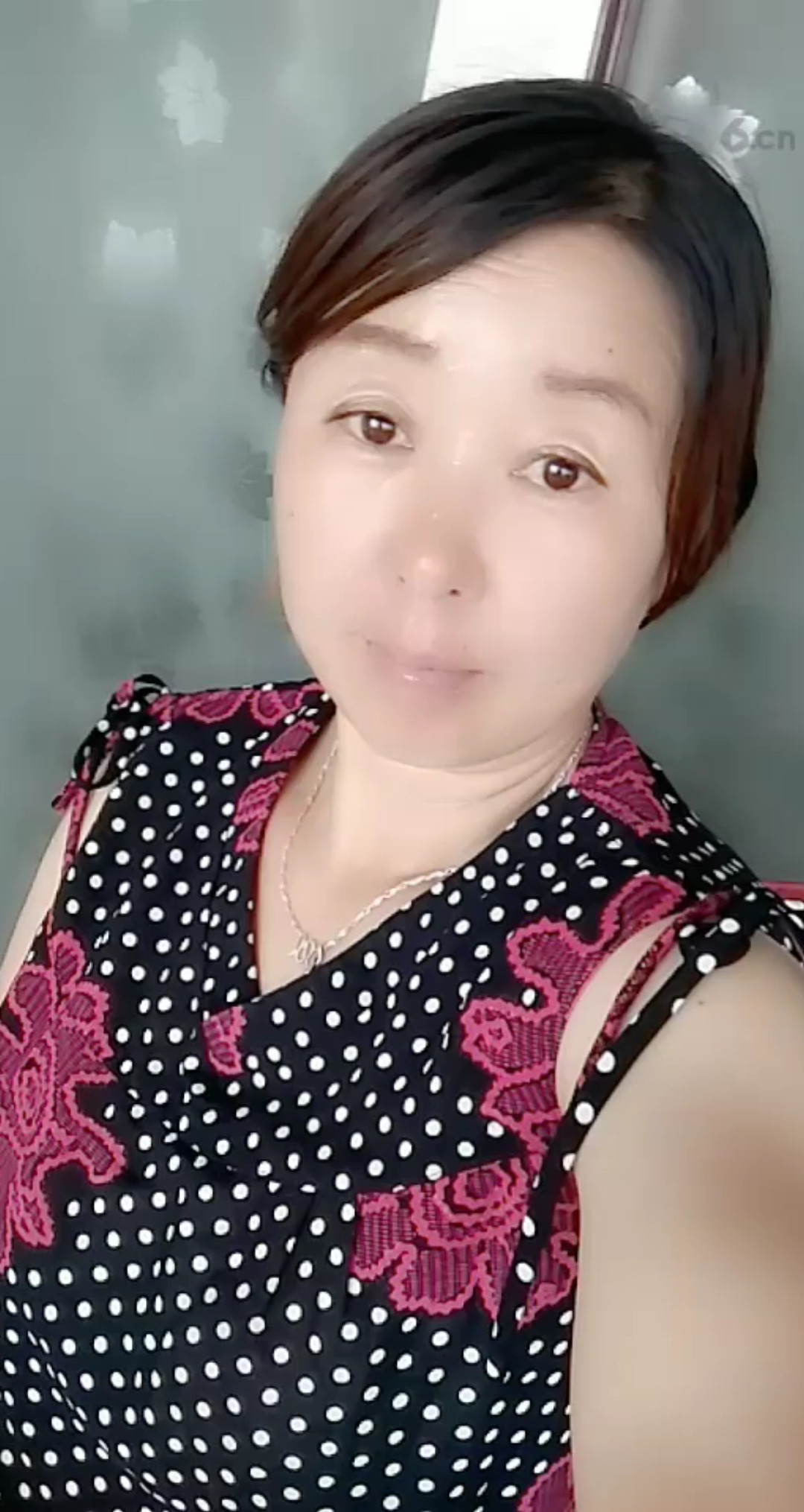 为什么抬头纹这么多呢？😳