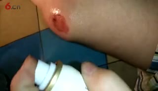 人生除了生死，其余都是擦伤。